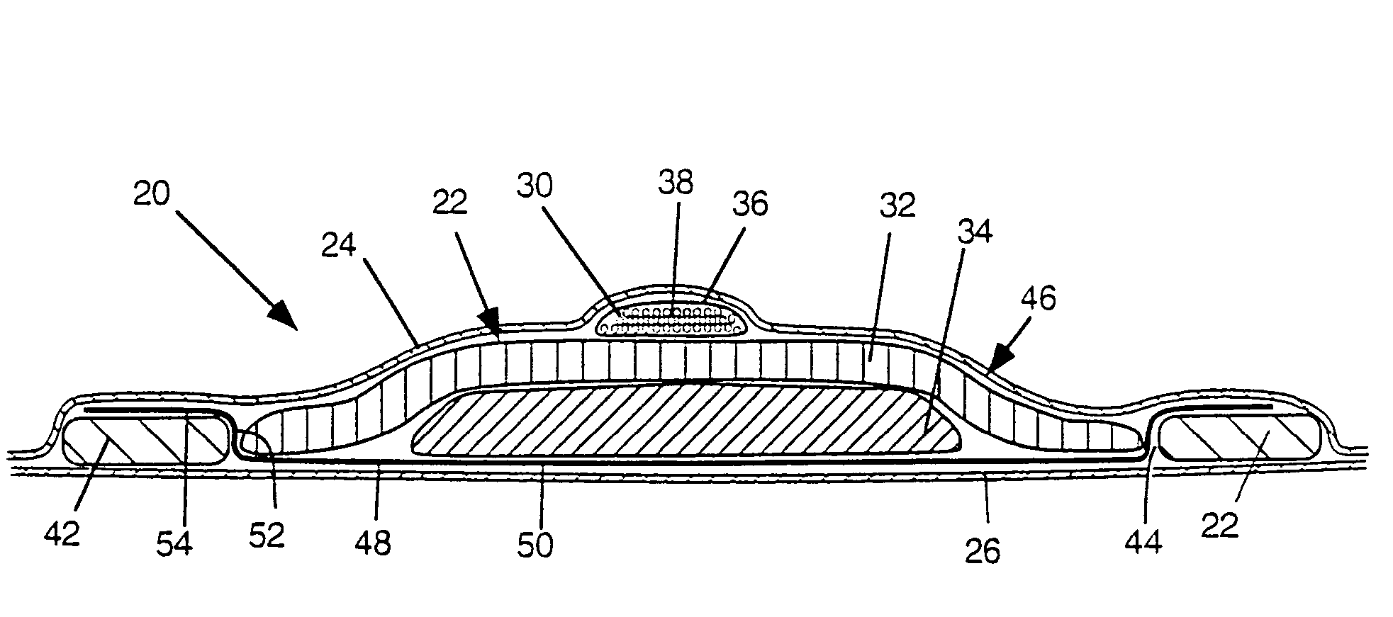 Absorbent articles with nits and free-flowing particles