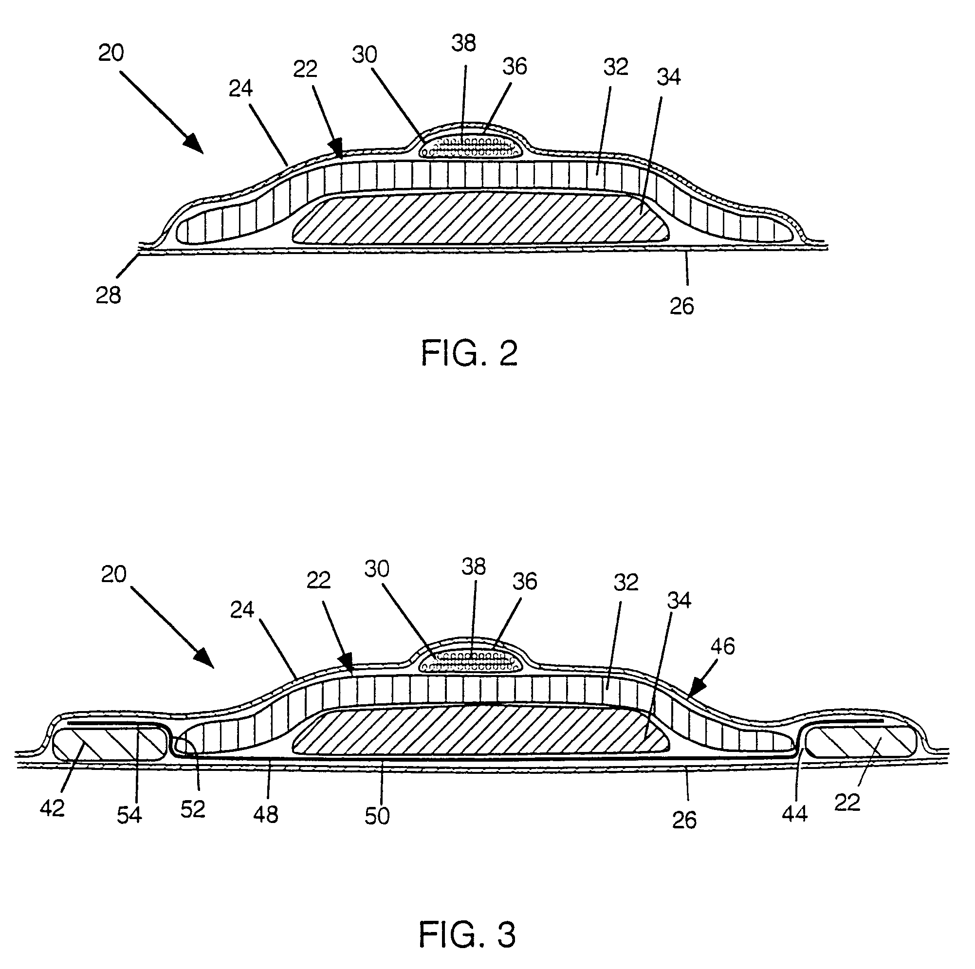 Absorbent articles with nits and free-flowing particles