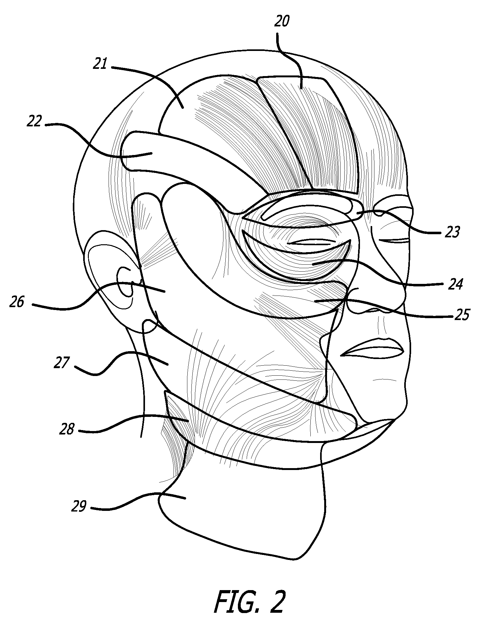 Methodology for non-surgical facial sculpting and lift