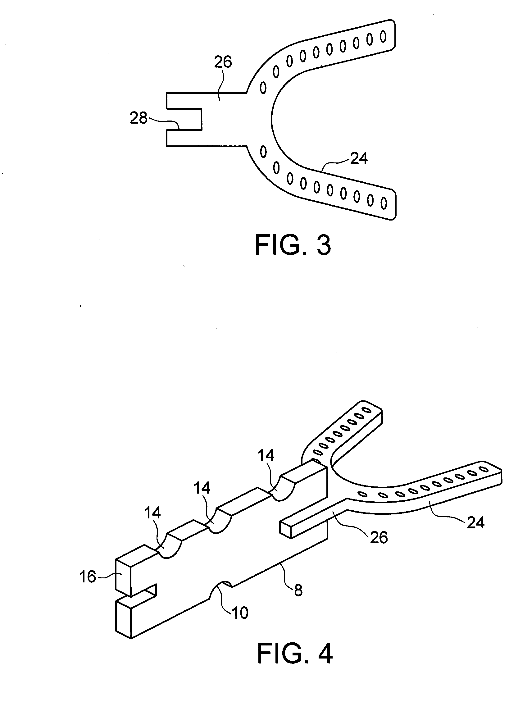 Method and apparatus for treating sleep apnea