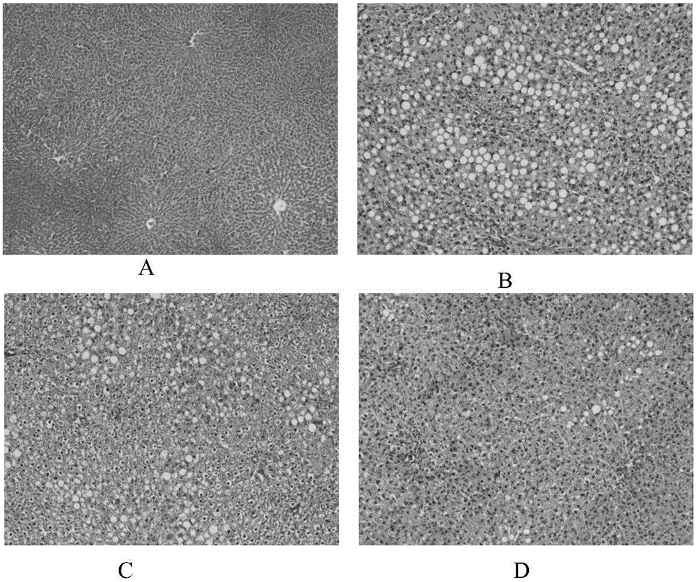 A traditional Chinese medicine composition for treating fatty liver and its application