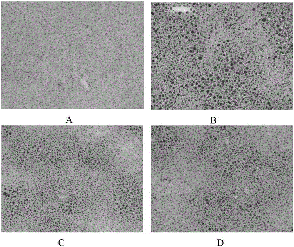 A traditional Chinese medicine composition for treating fatty liver and its application