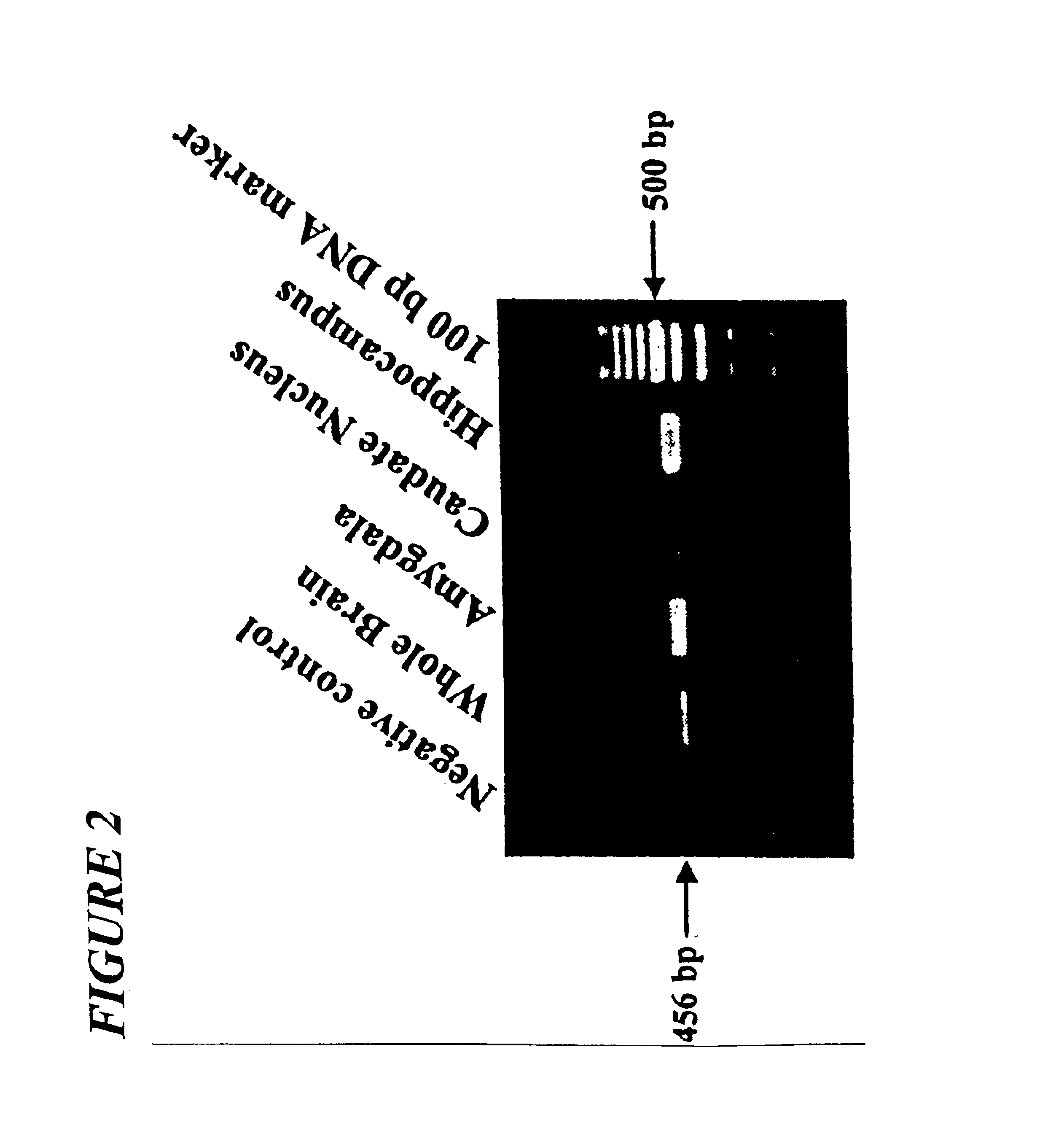 Primers for screening schizophrenia and a method thereof