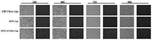 Method for preparing mRNA and application of the mRNA in tumor treatment