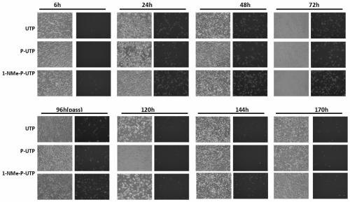 Method for preparing mRNA and application of the mRNA in tumor treatment