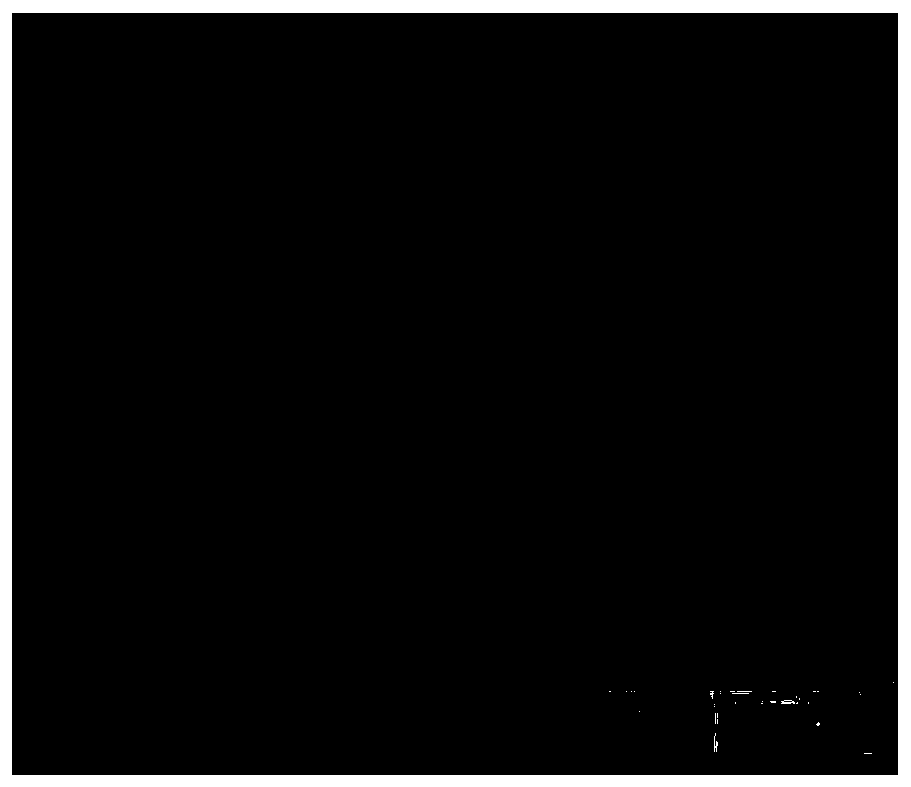 Preparation method of nano-silver/polydopamine/polypropylene composite patch material