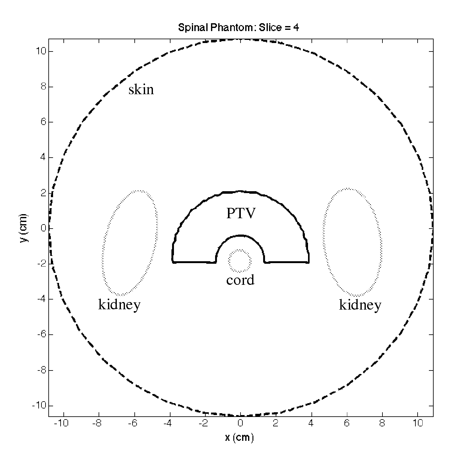 Multi-objective radiation therapy optimization method