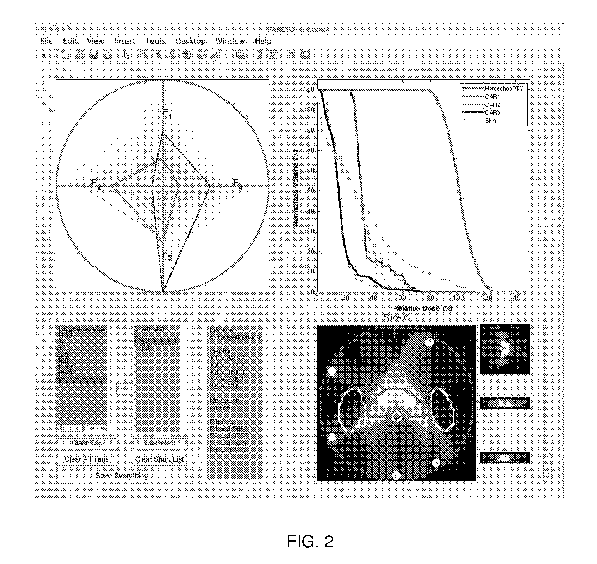 Multi-objective radiation therapy optimization method