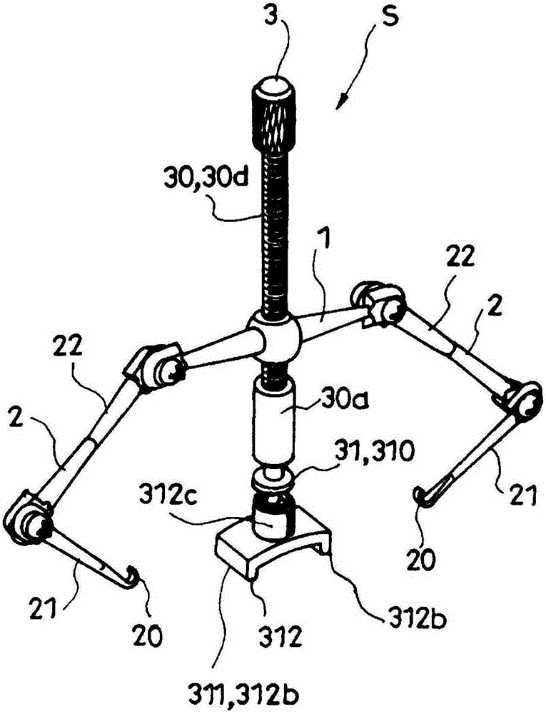 Pincer nail correction instrument