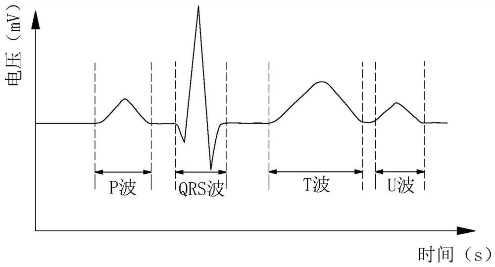 Electrocardio record labeling method and device, equipment and storage medium