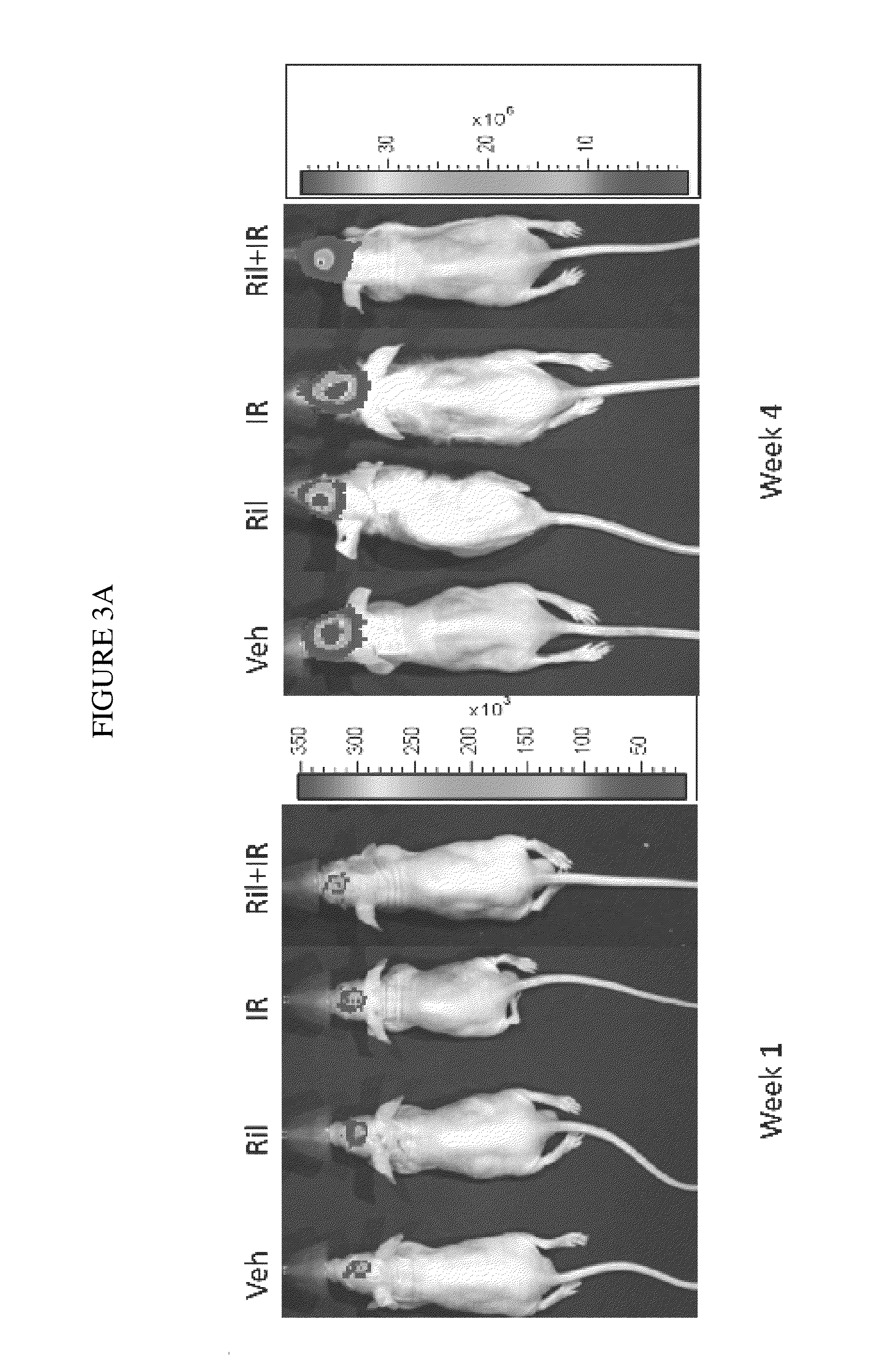 Combination therapy using riluzole to enhance tumor sensitivity to ionizing radiation