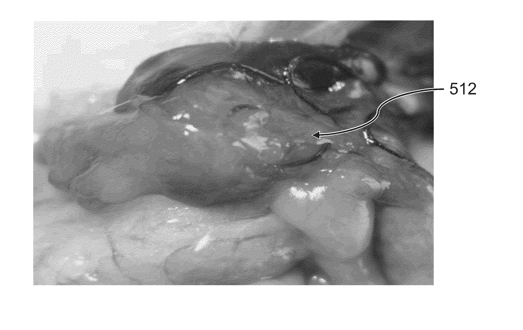 METHOD FOR REVERSING RECENT-ONSET TYPE 1 DIABETES (T1D) BY ADMINISTERING SUBSTANCE P (sP)