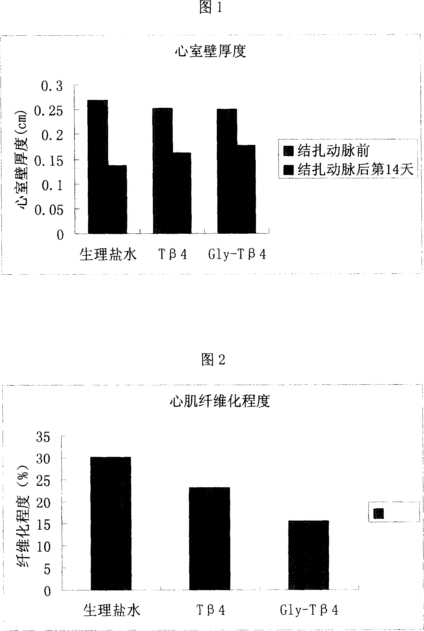 Thymosin beta4 derivative and itsuse