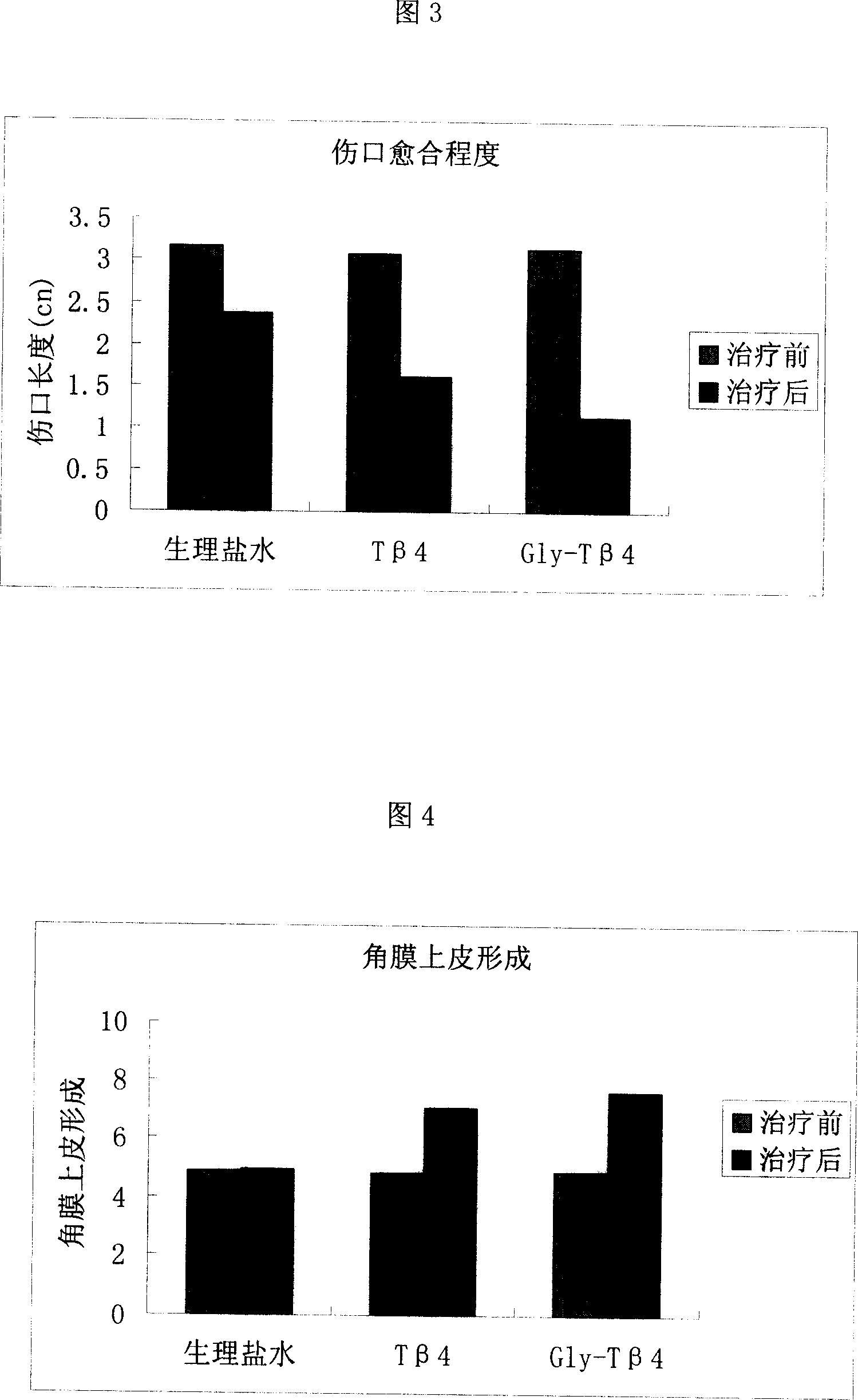 Thymosin beta4 derivative and itsuse