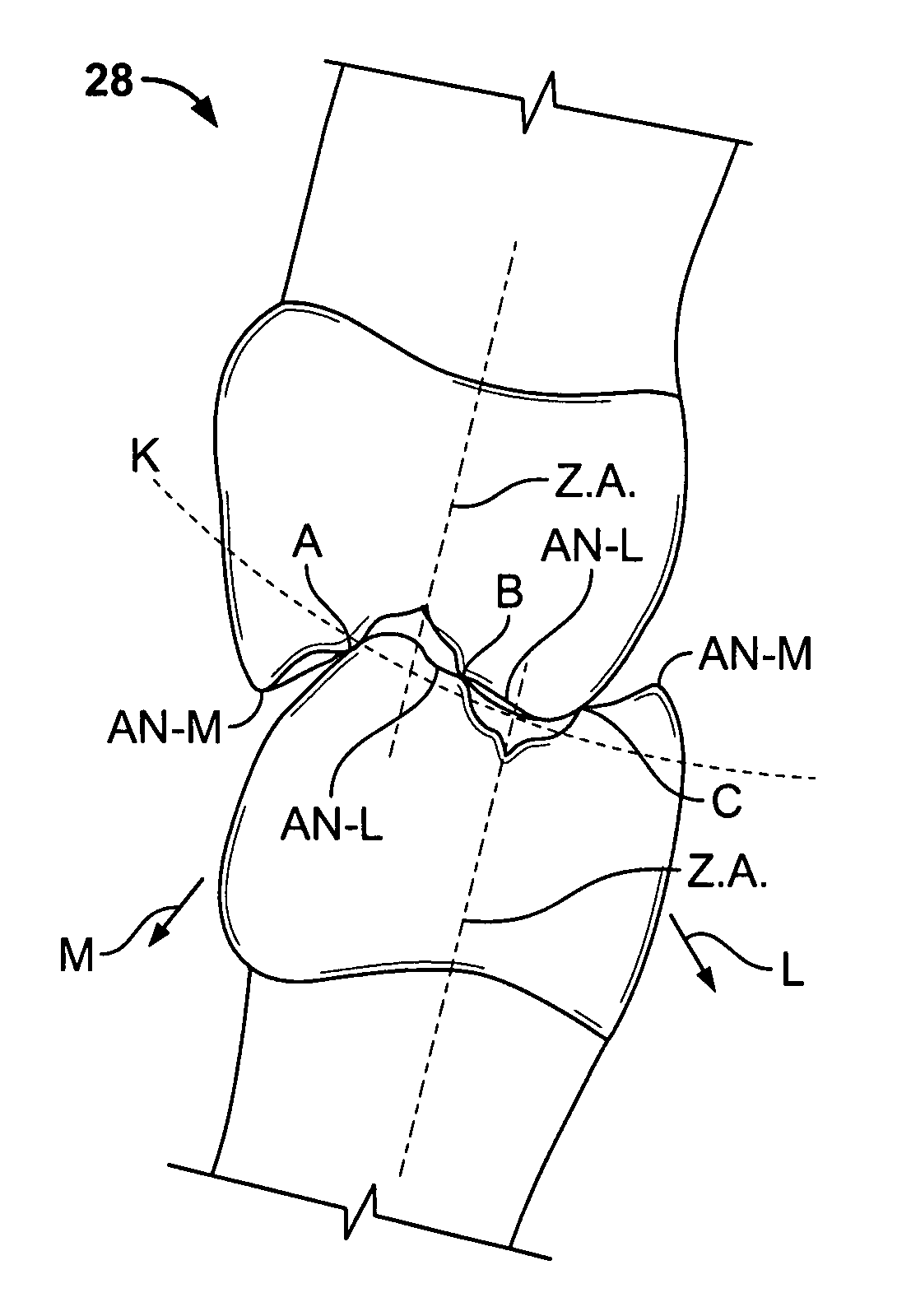 Set of teeth