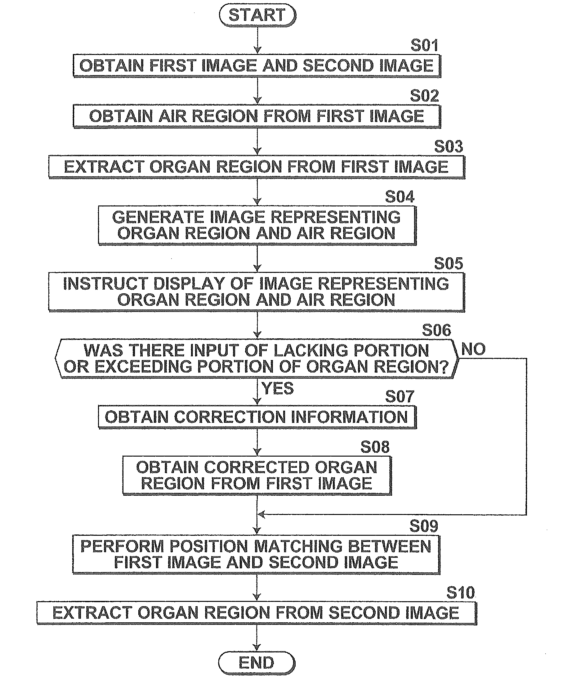 Diagnosis assistance apparatus, method and program