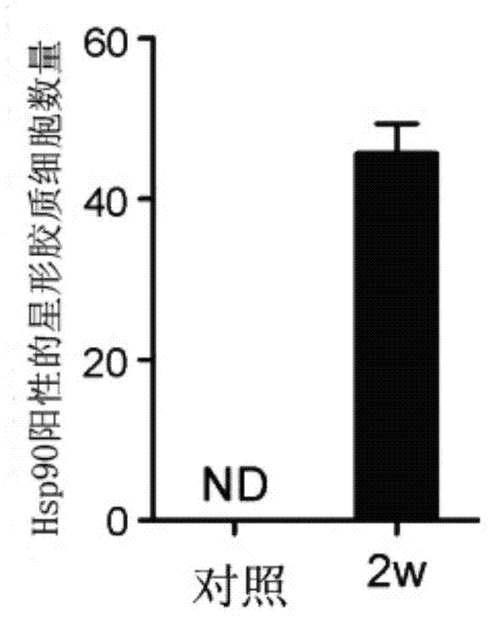 Application of 17-allylamine-17-demethoxygeldanamycin in preparation of medicine for treating epilepsy