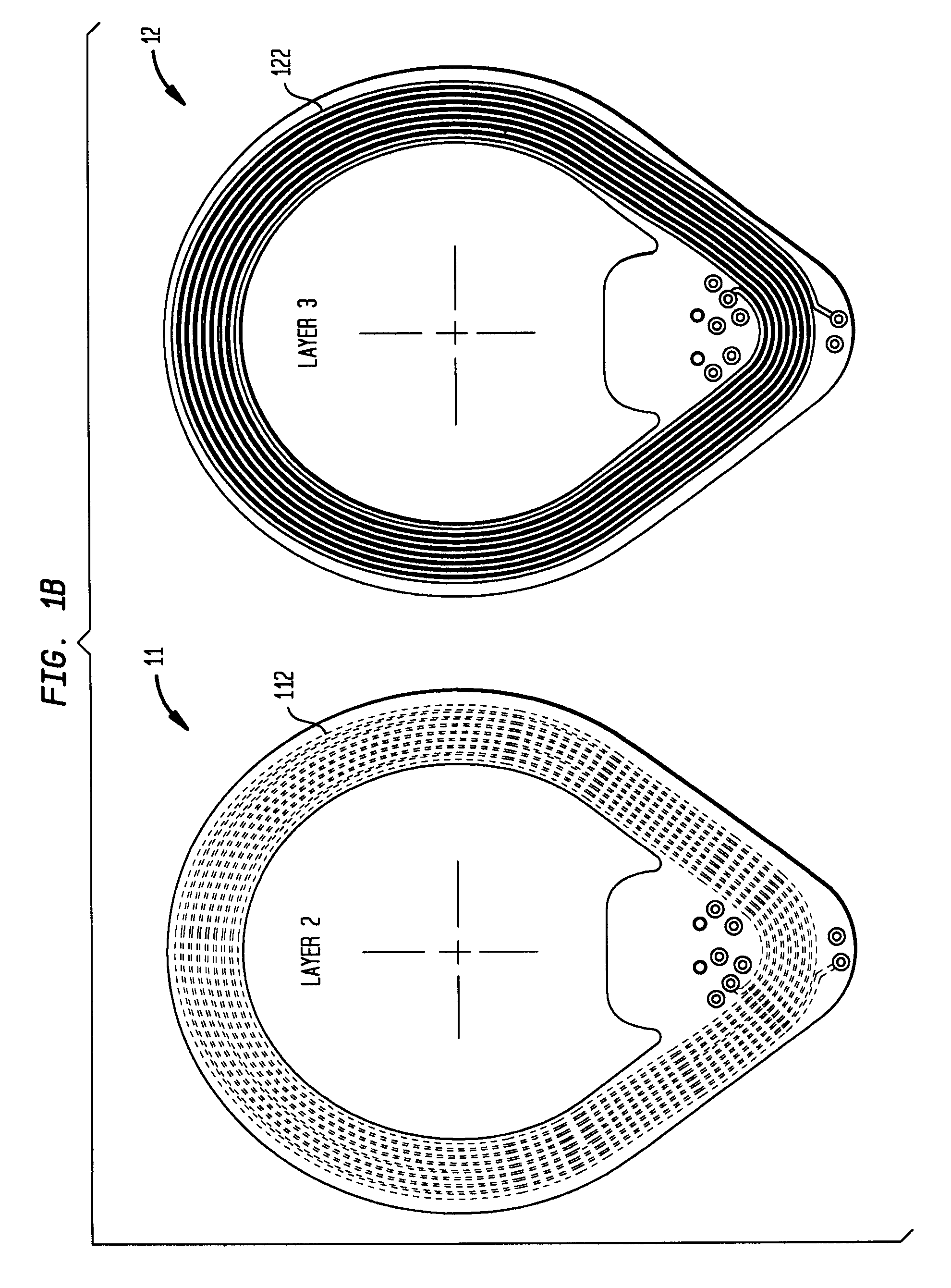 Transceiver coil for auditory prosthesis