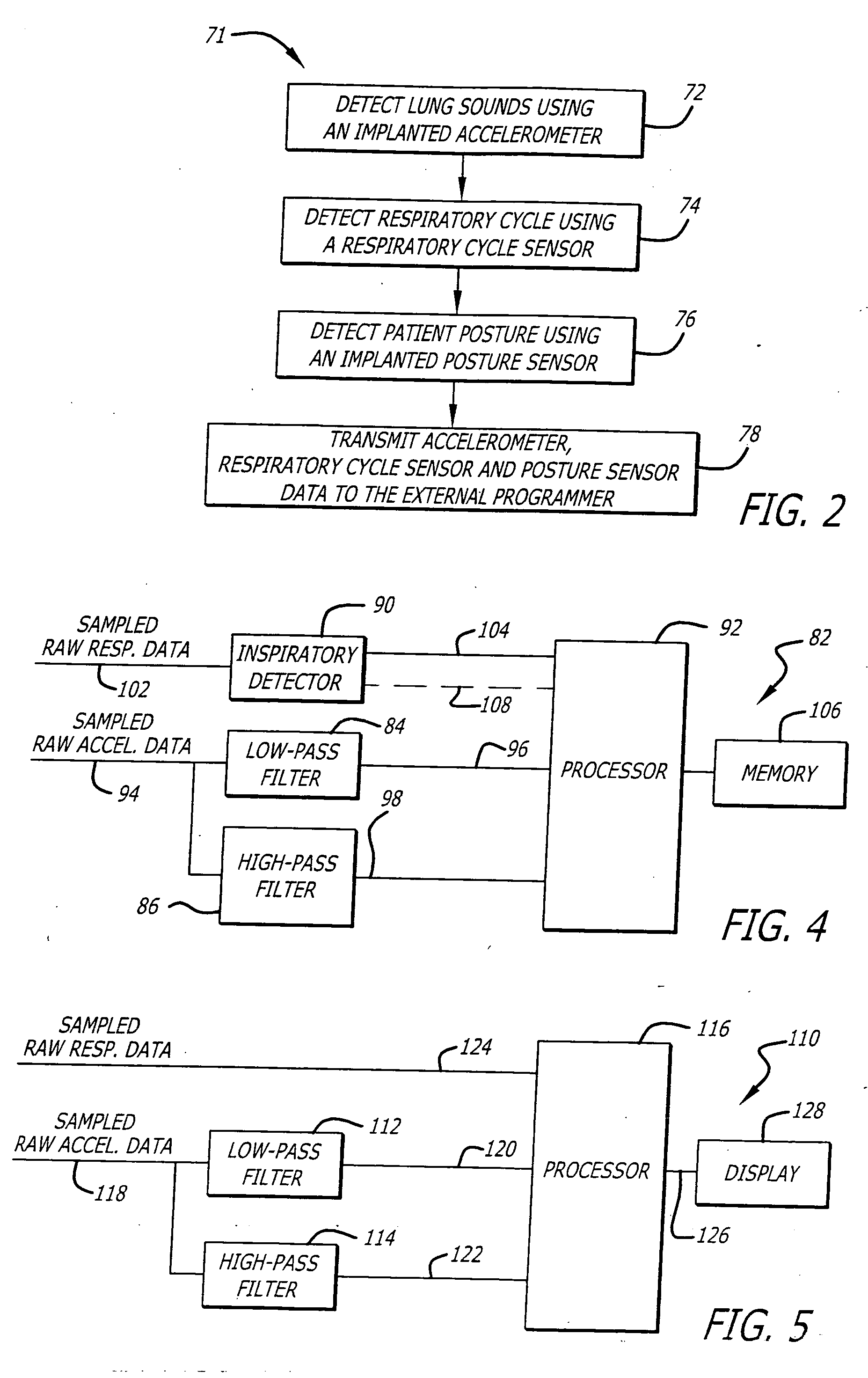 Apparatus and method for detecting lung sounds using an implanted device