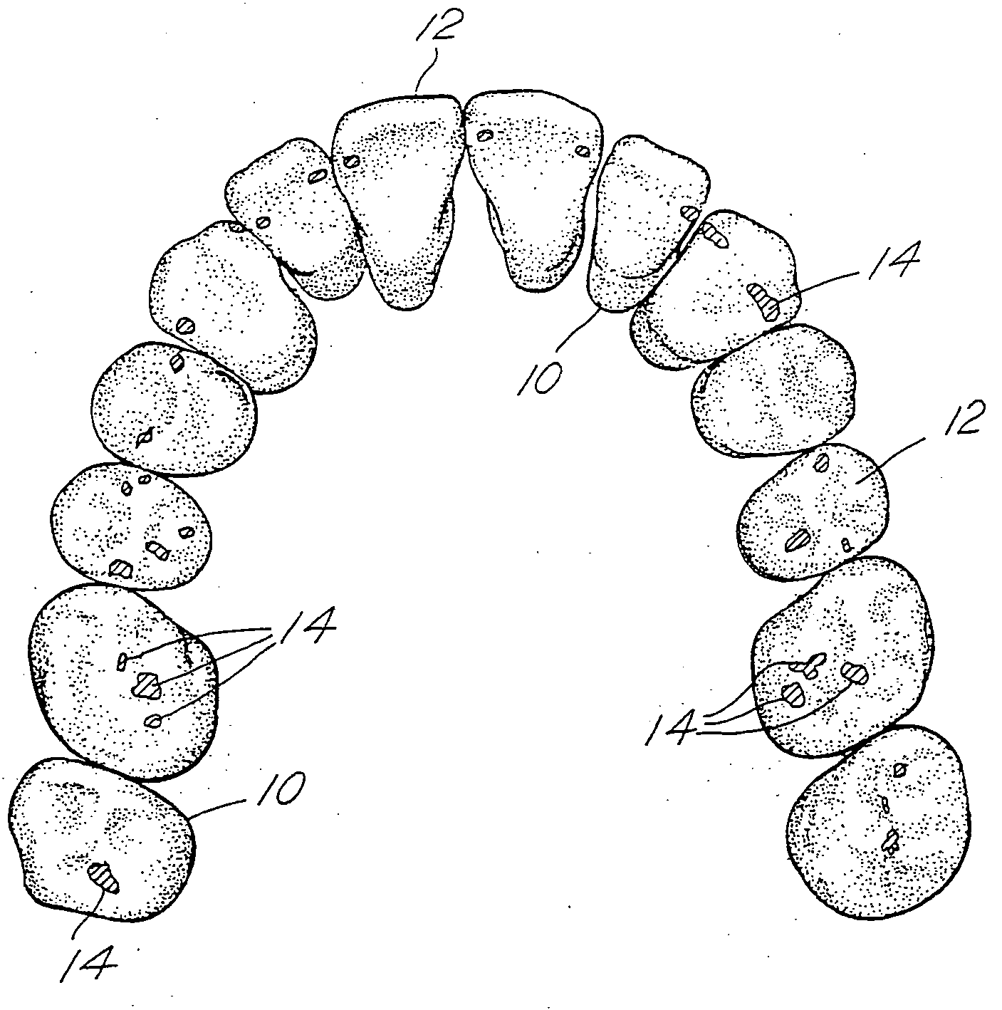 Three-dimensional occlusal and interproximal contact detection and display using virtual tooth models