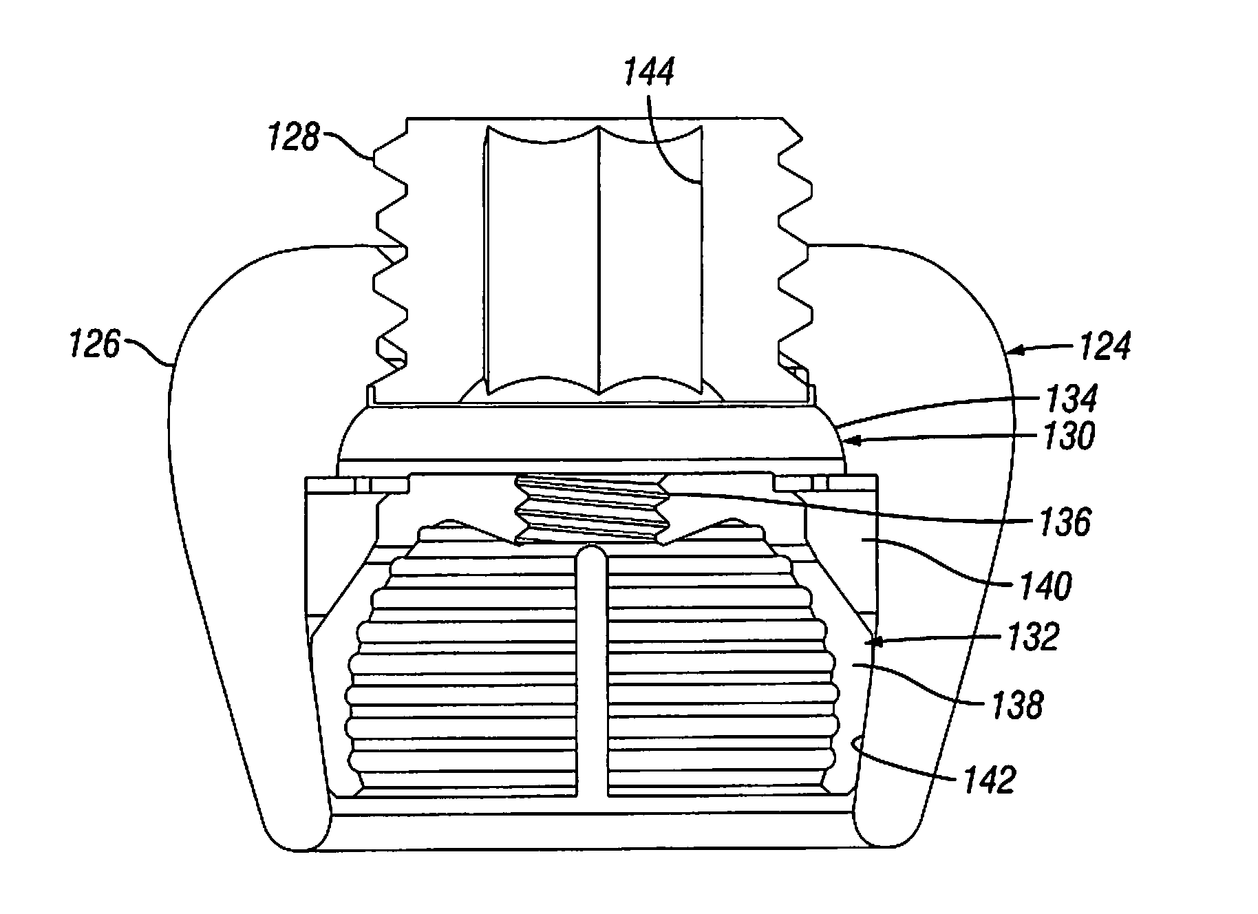 Orthopedic Fixation Devices and Methods of Installation Thereof