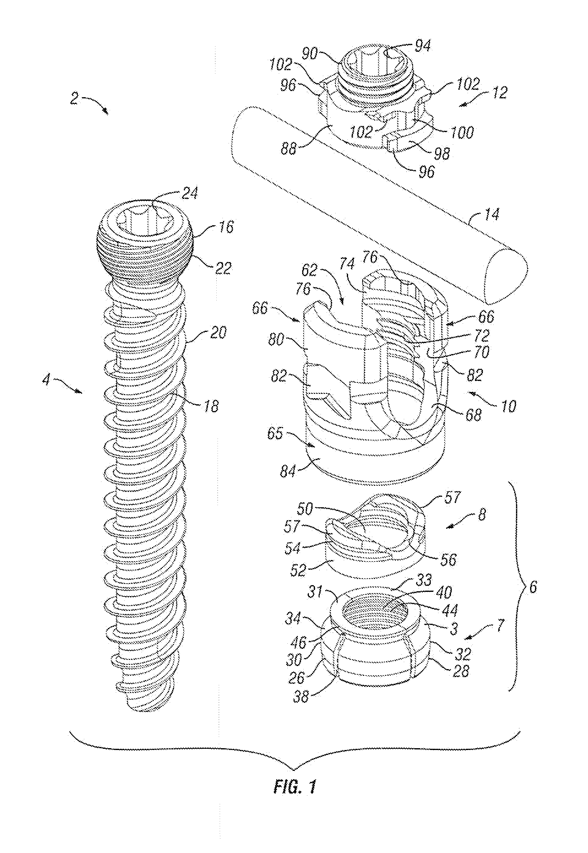 Orthopedic Fixation Devices and Methods of Installation Thereof