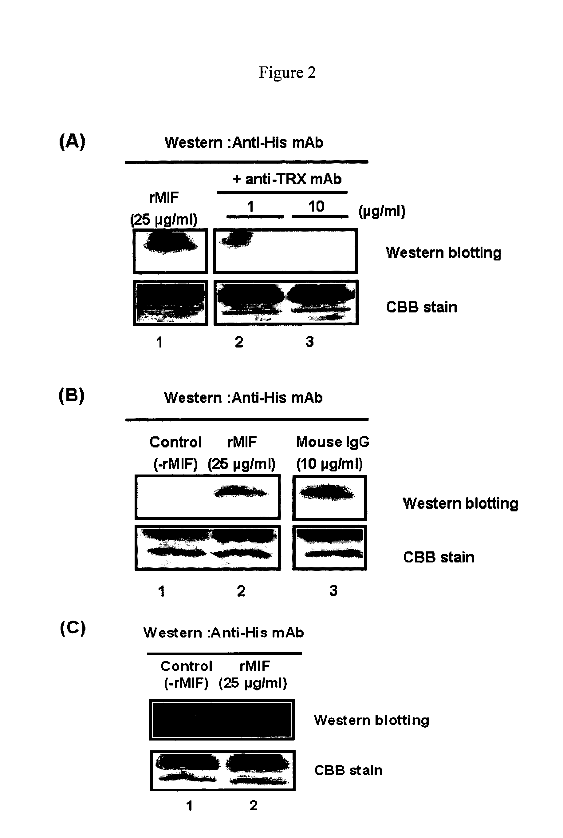 Preventive or therapeutic agent containing anti thioredoxin antibody polypeptide as an active ingredient for disorders