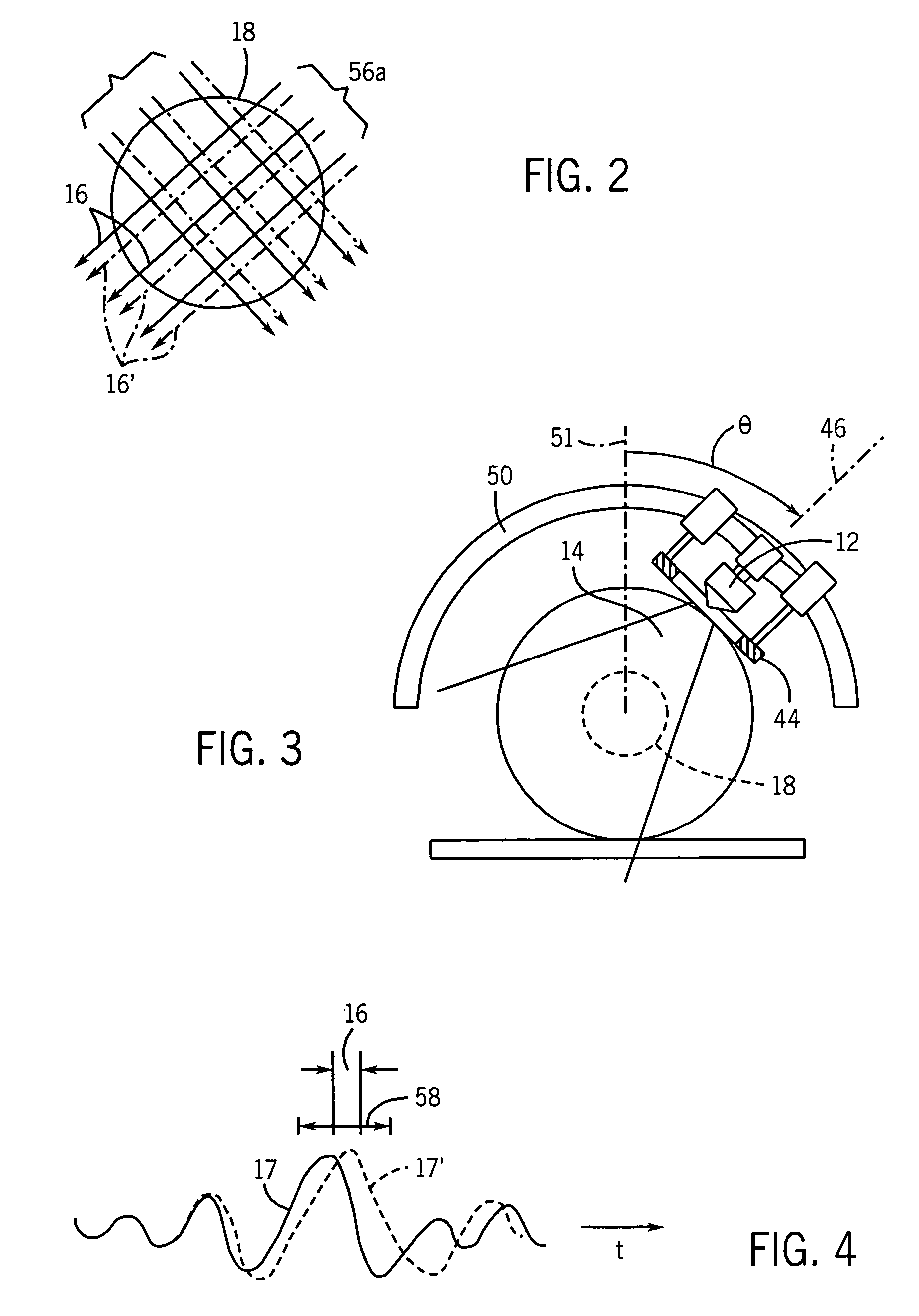 Ultrasonic elastography with angular compounding