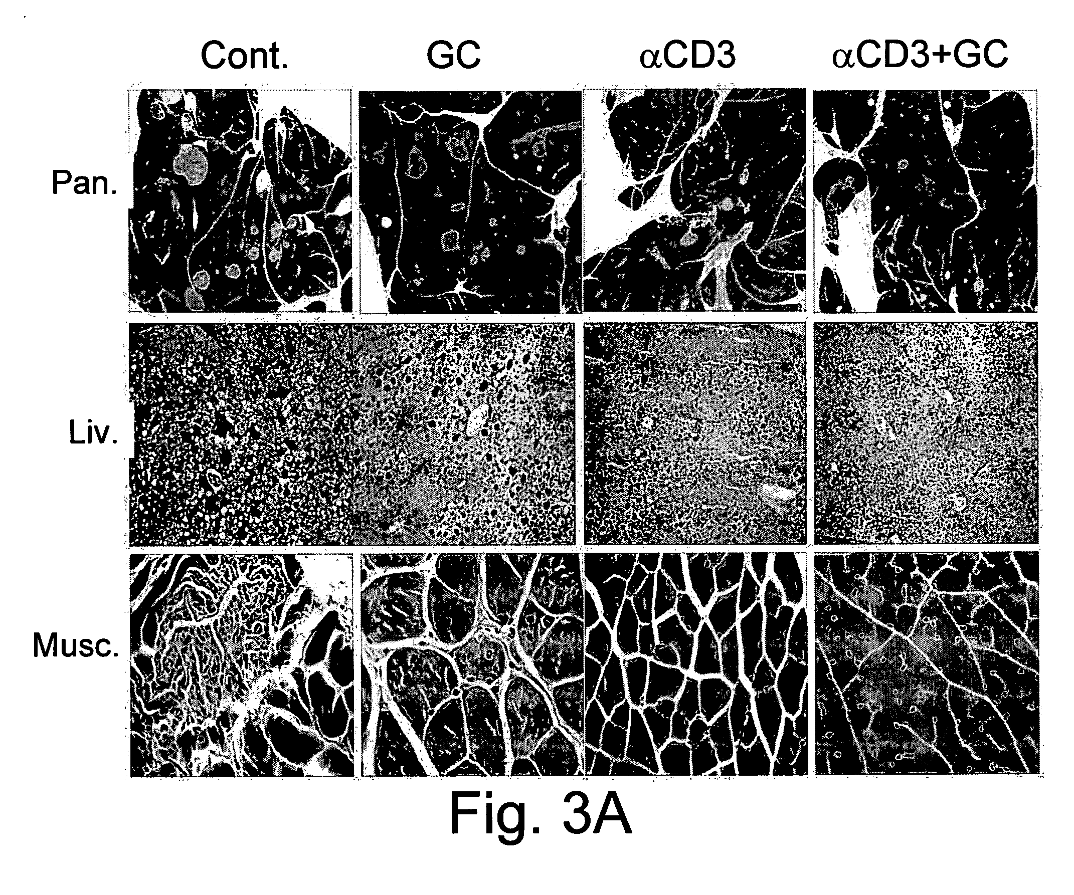 Combination therapy of beta-glycolipids and antibodies for the treatment of immune-related disorders