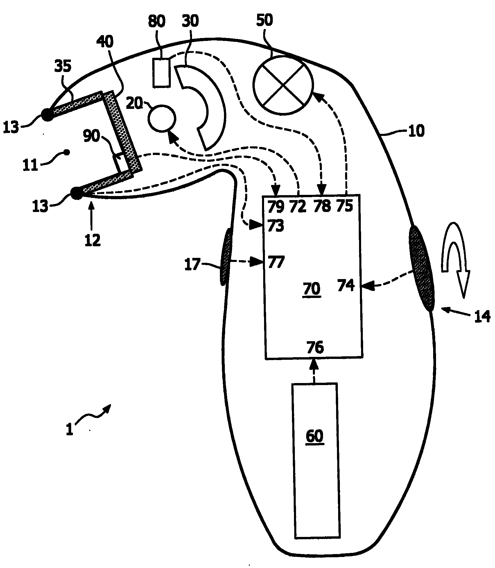 Photo-epilation device