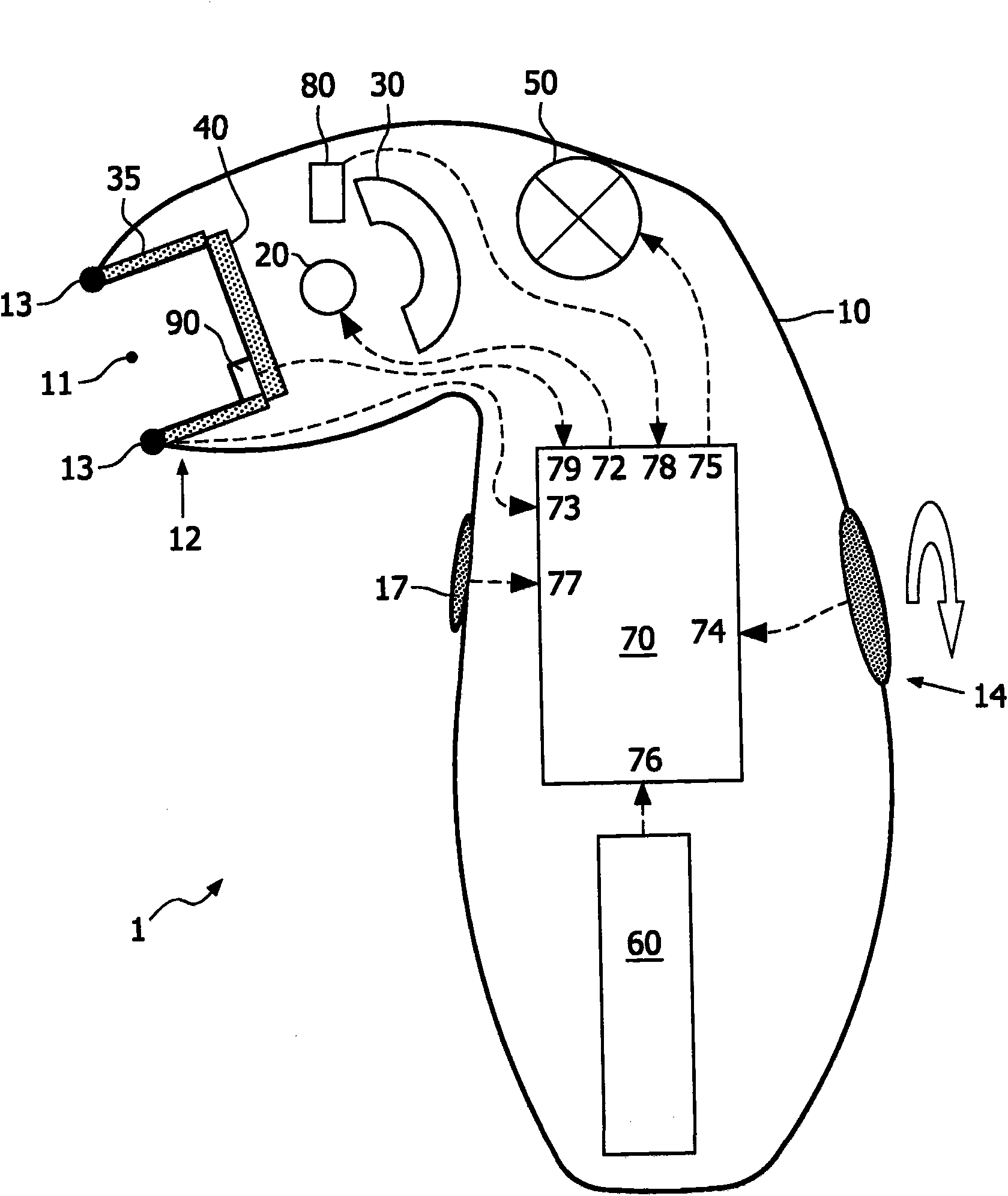 Photo-epilation device