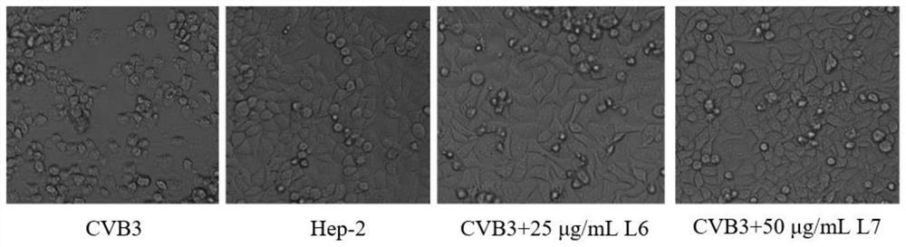 Application of polyiodobenzoic acid as cvb3 virus inhibitor