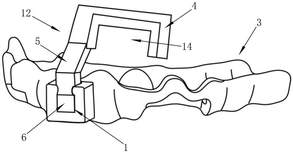 In situ bone harvesting and bone grafting guide plate for horizontal bone augmentation and manufacturing method thereof