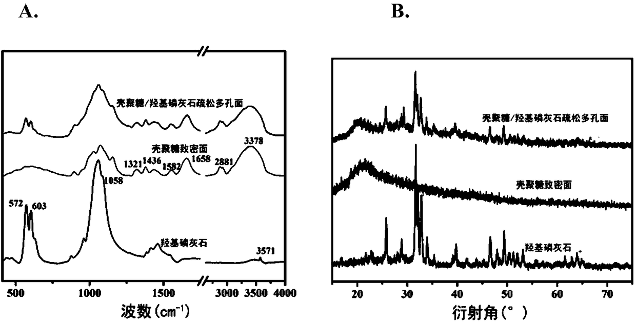 GTR (guided tissue regeneration) membrane and preparation method thereof