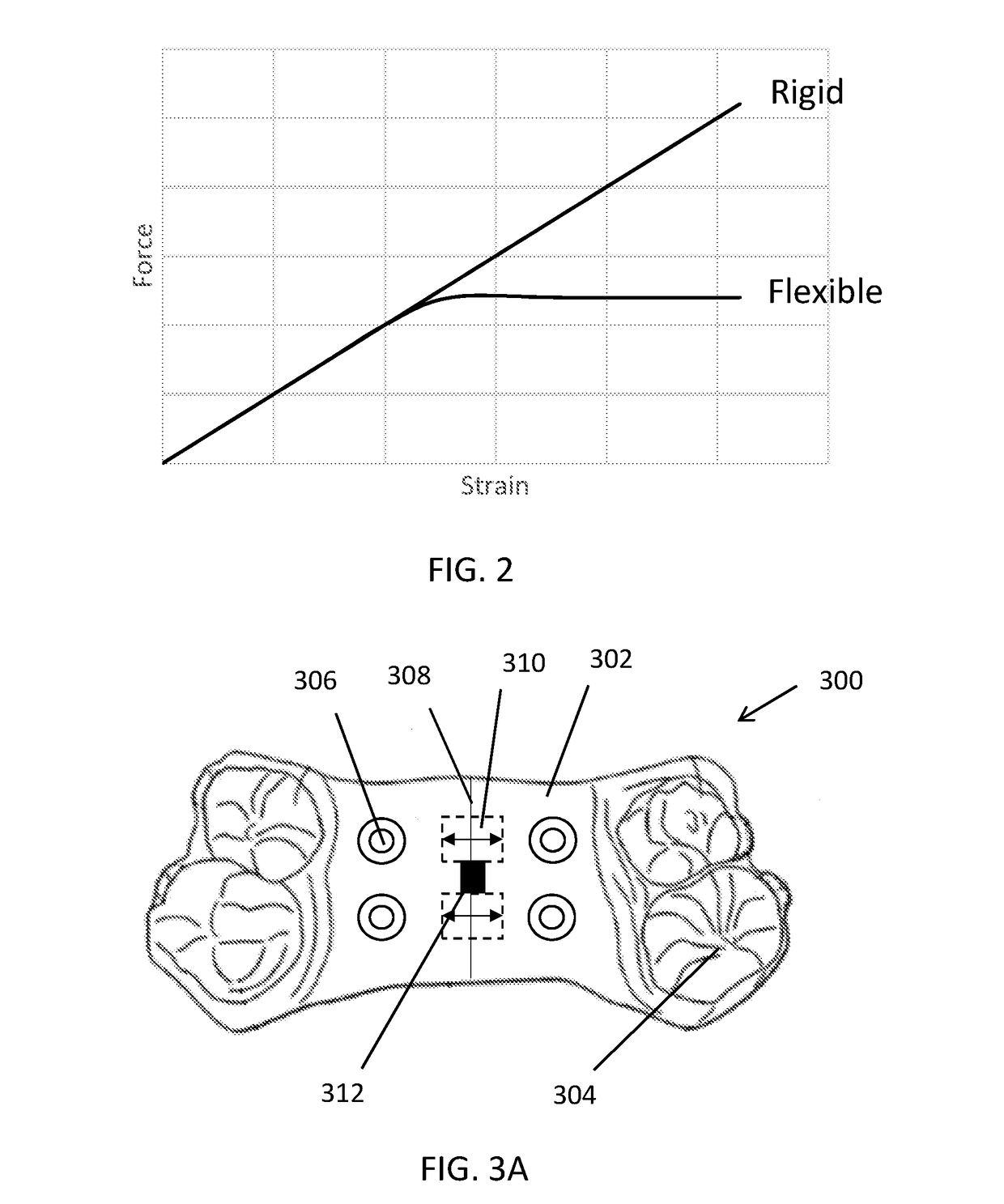 Palatal expander with skeletal anchorage devices