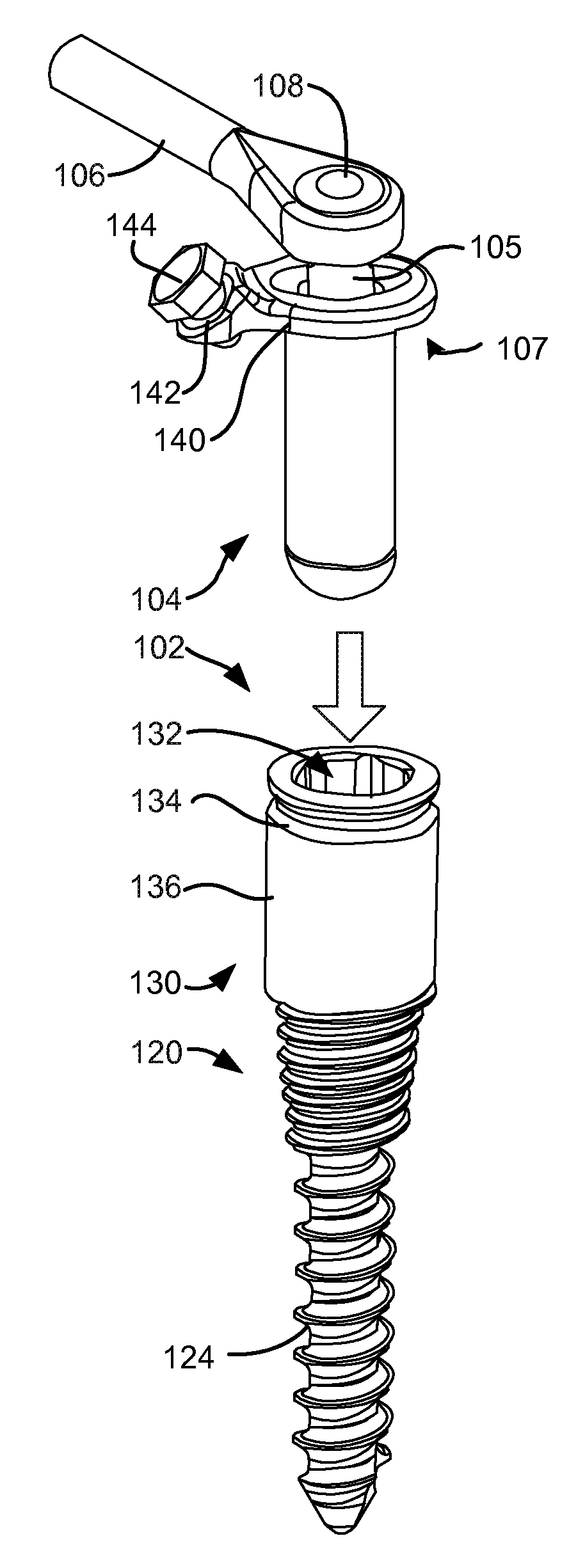 Load-sharing bone anchor having a deflectable post with a compliant ring and method for stabilization of the spine