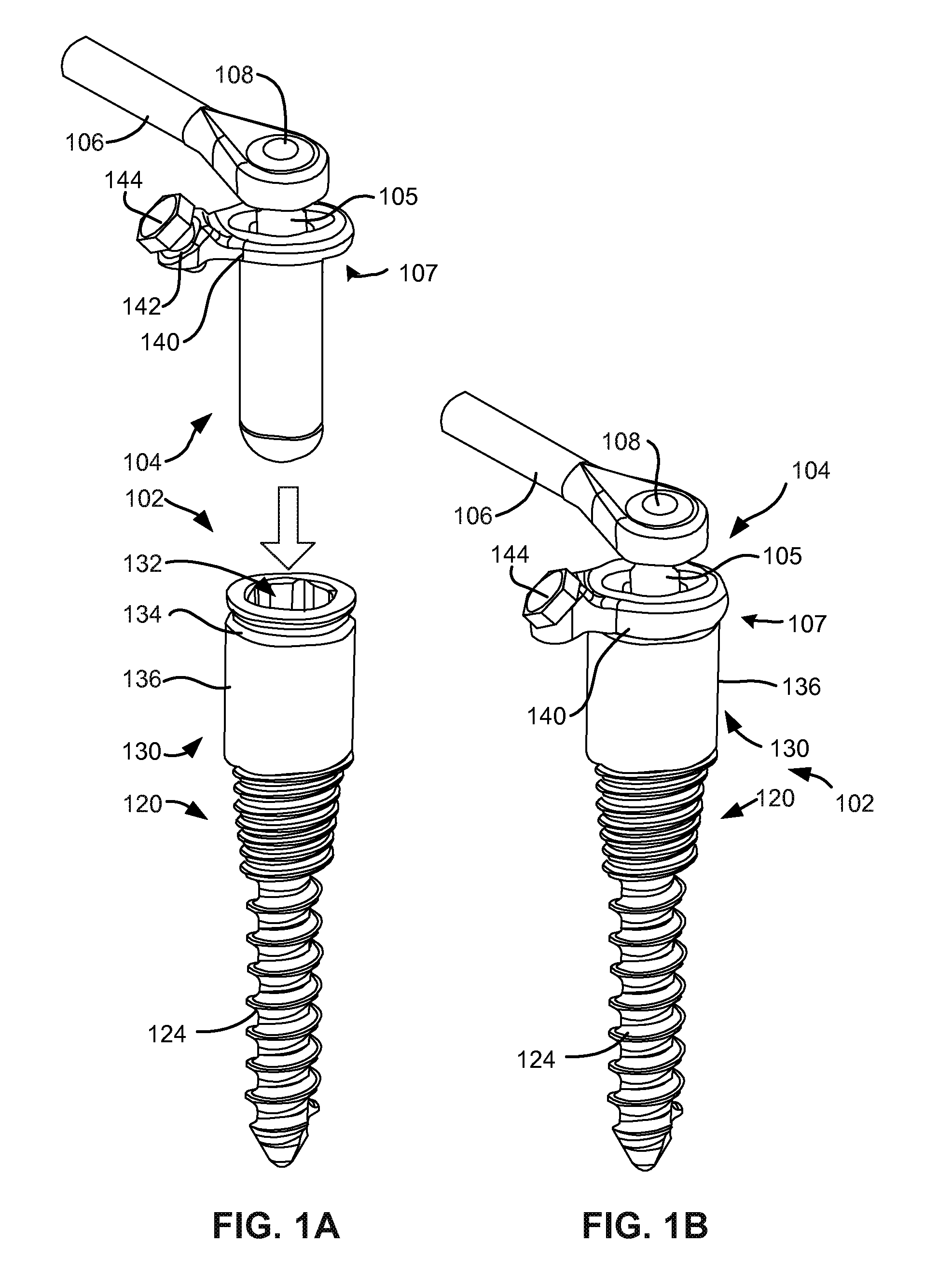 Load-sharing bone anchor having a deflectable post with a compliant ring and method for stabilization of the spine