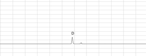 Fingerprint spectrum construction and preparation method of compound pearl detoxification oral liquid