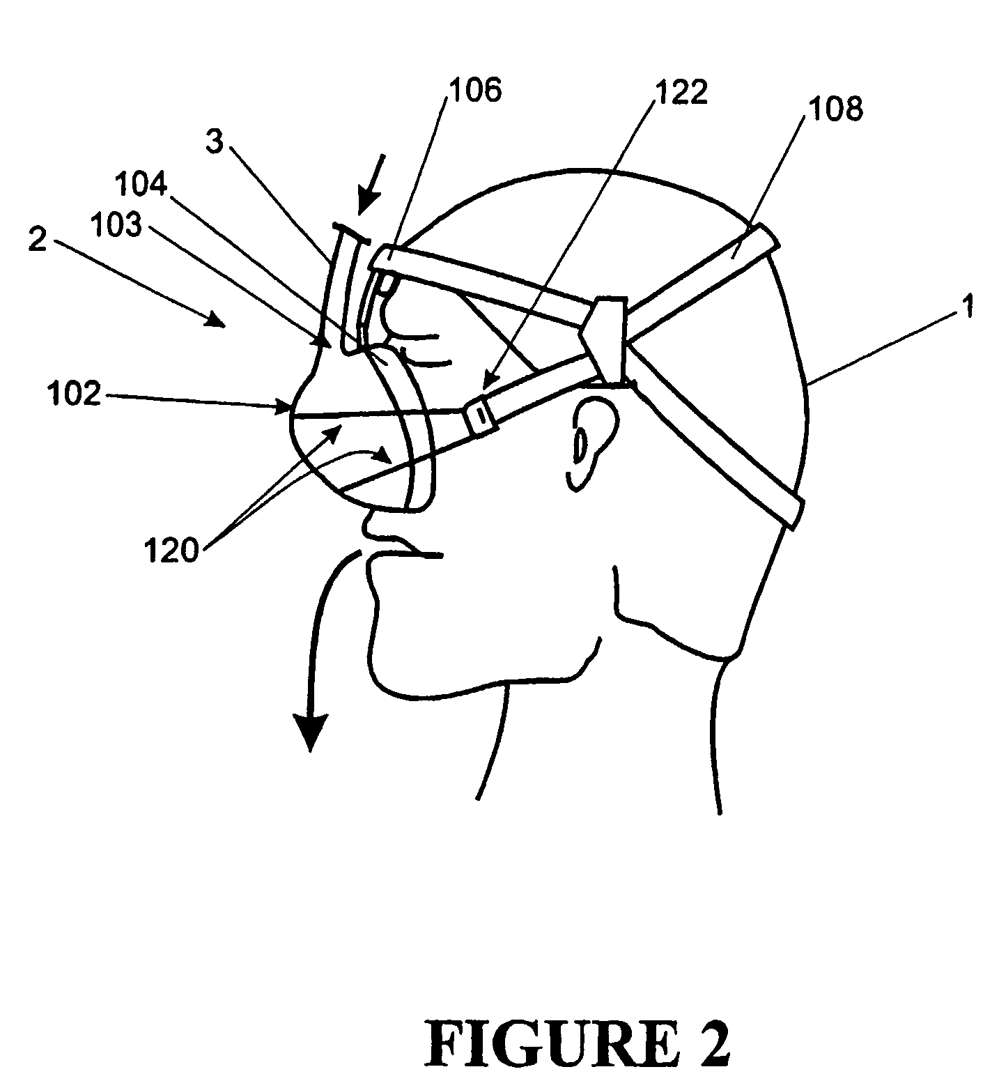 Breathing assistance apparatus