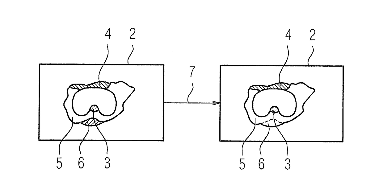 Method and magnetic resonance apparatus for correction of a B0 map for chemical shifts