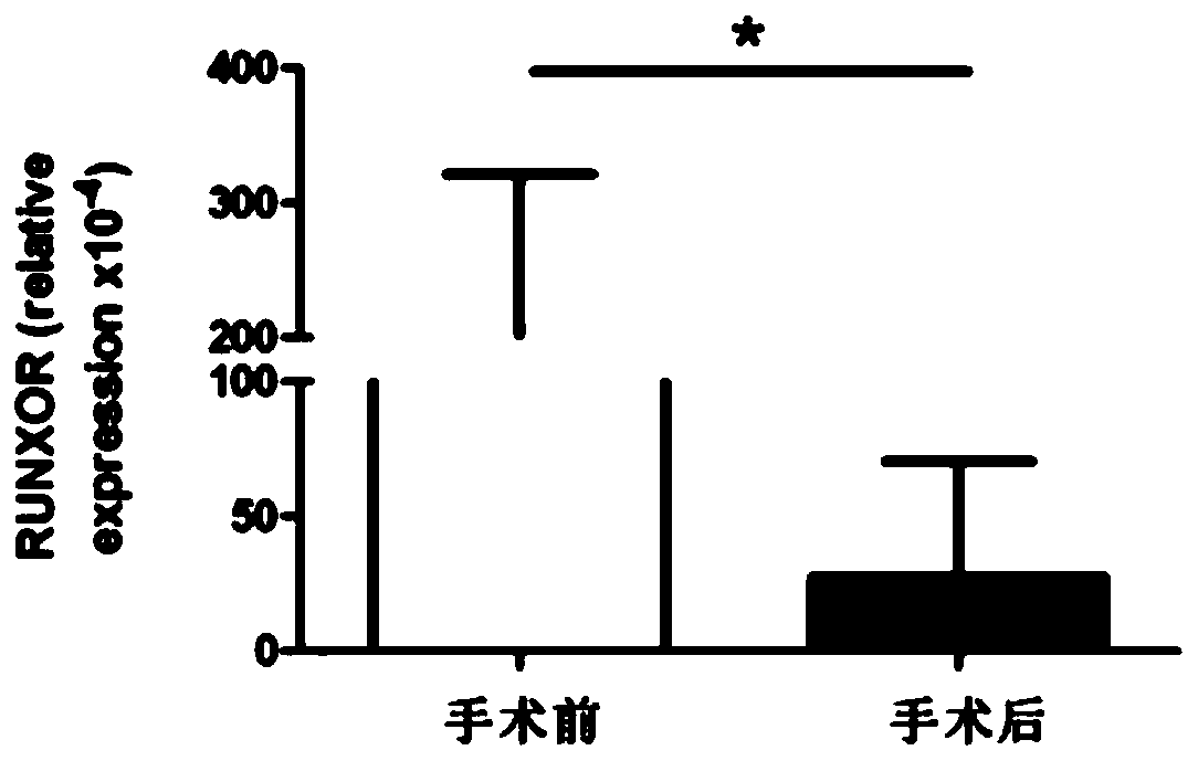 Application of LncRNA marker in detection or evaluation of immune function of lung cancer