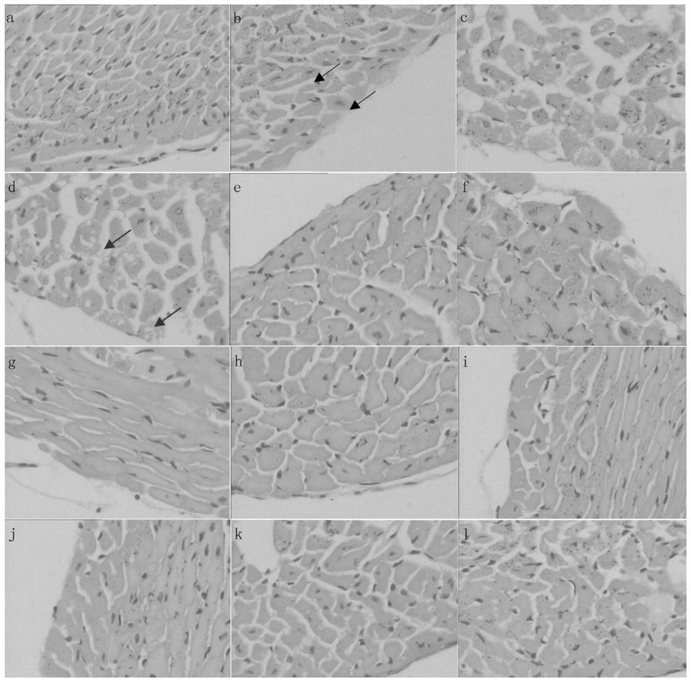 Application of erucamide in preparation of medicine for treating myocardial injury