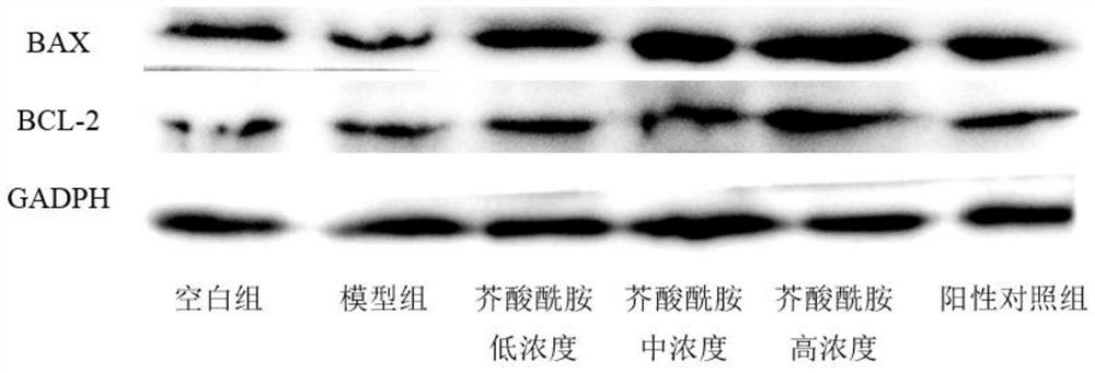 Application of erucamide in preparation of medicine for treating myocardial injury