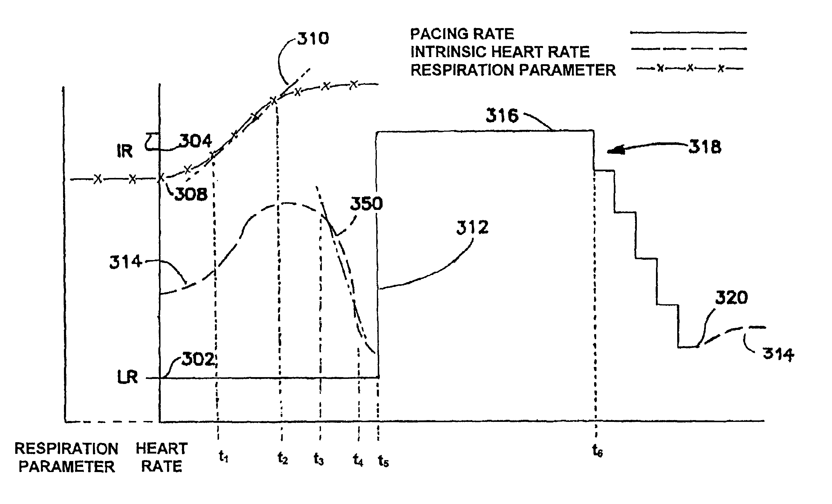 Methods and apparatus for detection and treatment of syncope