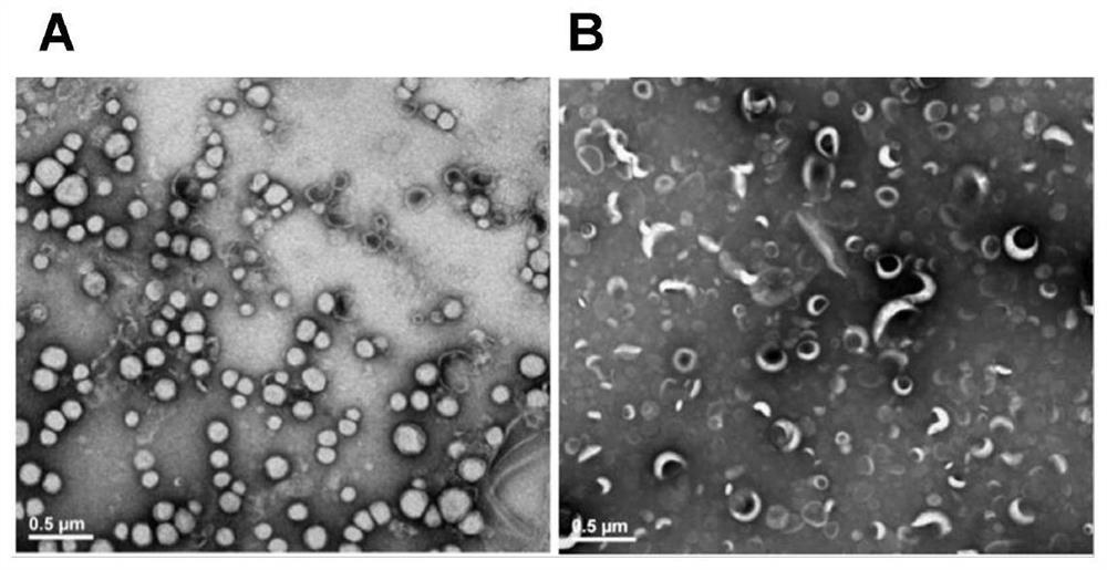 Hyaluronic acid modified ethosome, acupoint drug delivery system containing hyaluronic acid modified ethosome and application of system