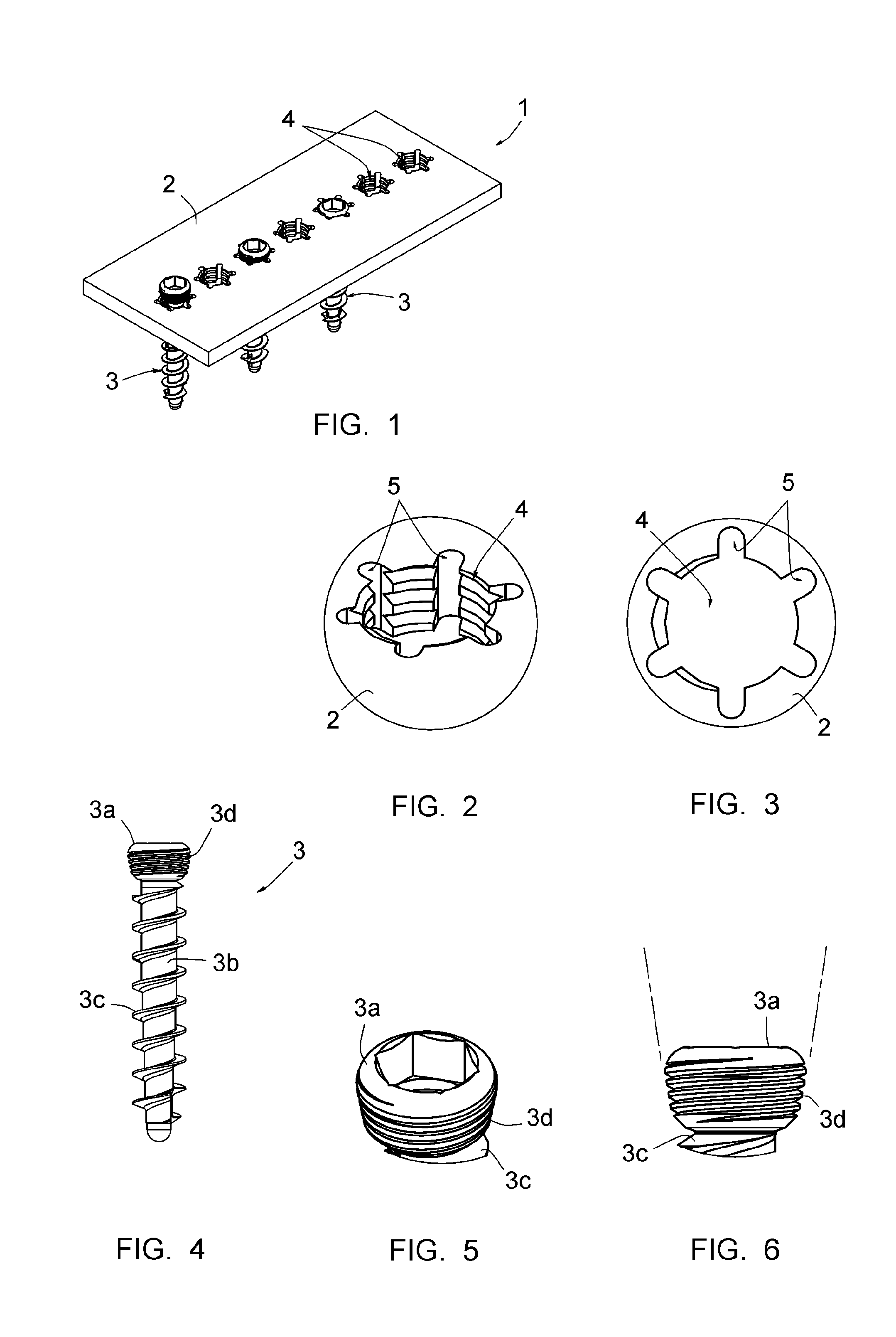 Assembly comprising an implantable part designed to be fastened to one or more bones or bone portions to be joined, and at least one screw for fastening the implantable part to said bone(s)