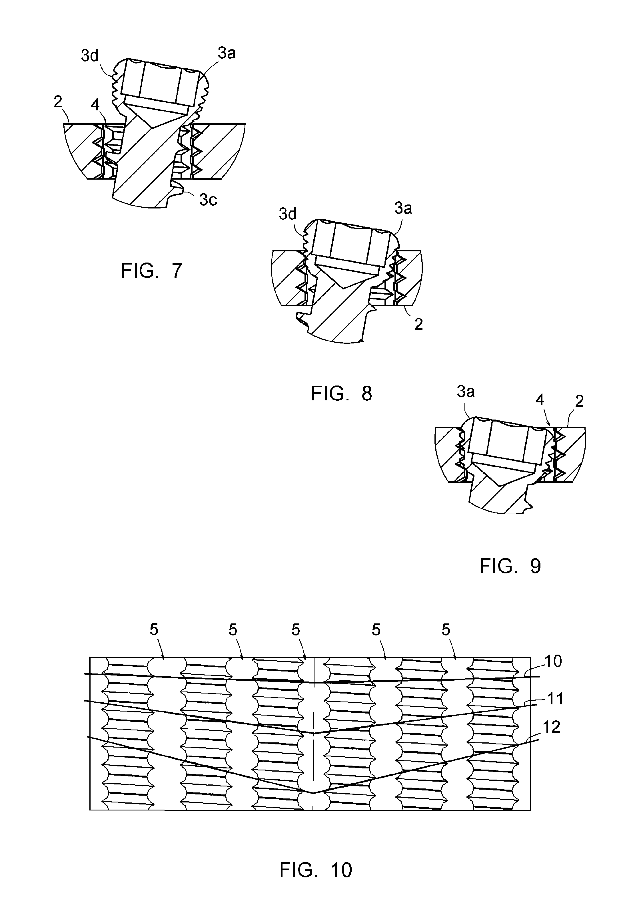 Assembly comprising an implantable part designed to be fastened to one or more bones or bone portions to be joined, and at least one screw for fastening the implantable part to said bone(s)