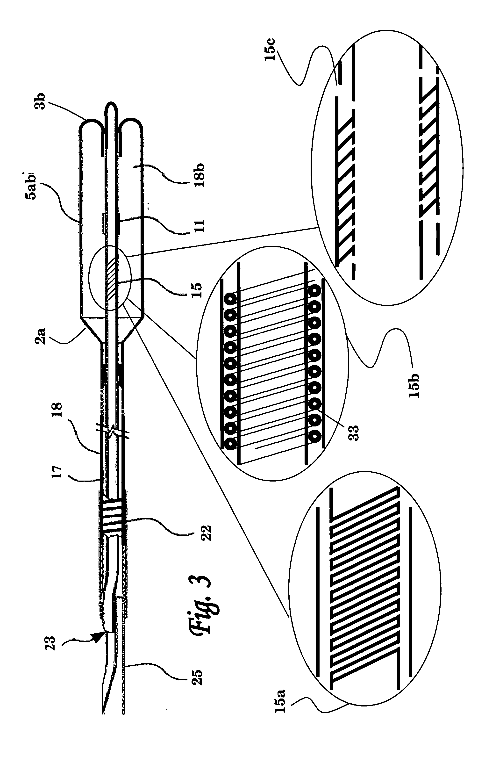 Balloon catheter system for treating vascular occlusions