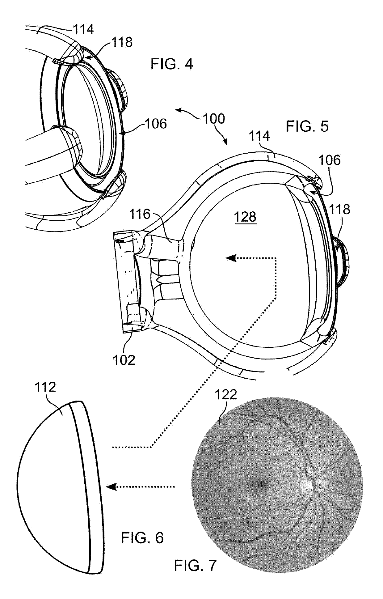 Simulating eye surgery