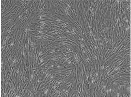 Preparation method and application of human endometrial stem cell compound repair factor